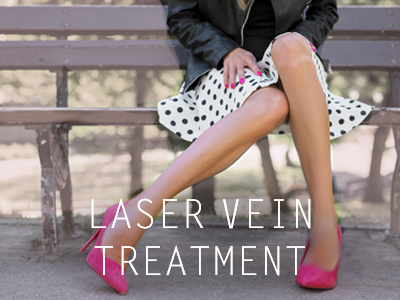 Laser Vein Treatment