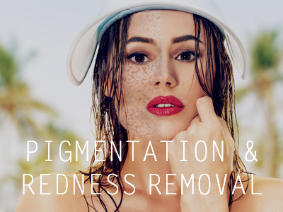 pigment removal englewood