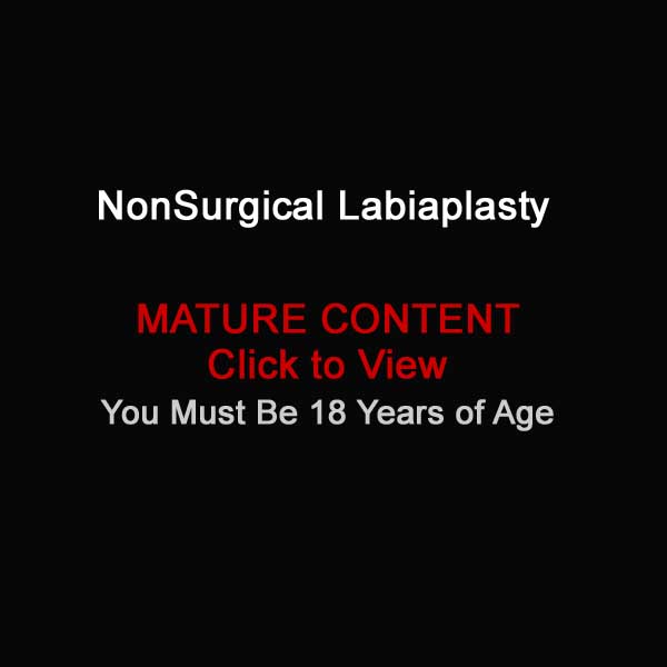 non-surgical labiaplasty