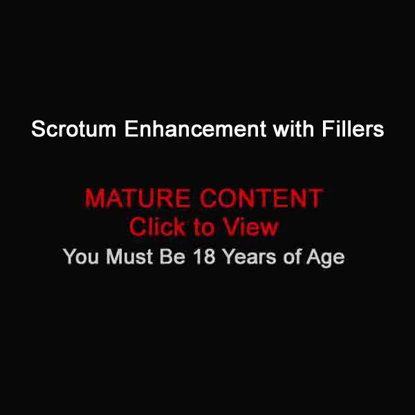 scrotum fillers Englewood, NJ